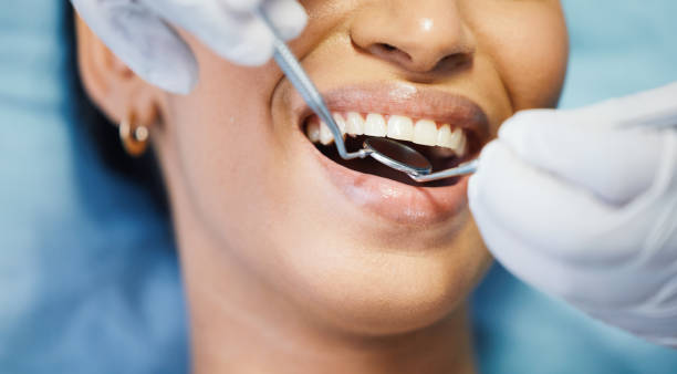 Best Chipped Tooth Repair Near Me  in Monroe, IA