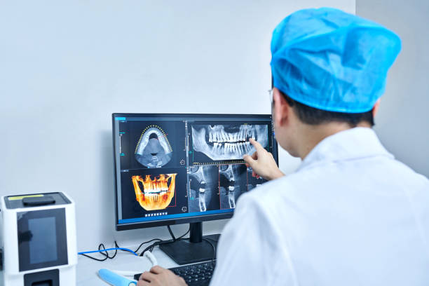 Best Chipped Tooth Repair Near Me  in Monroe, IA