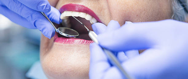 Best Knocked-Out Tooth Emergency  in Monroe, IA